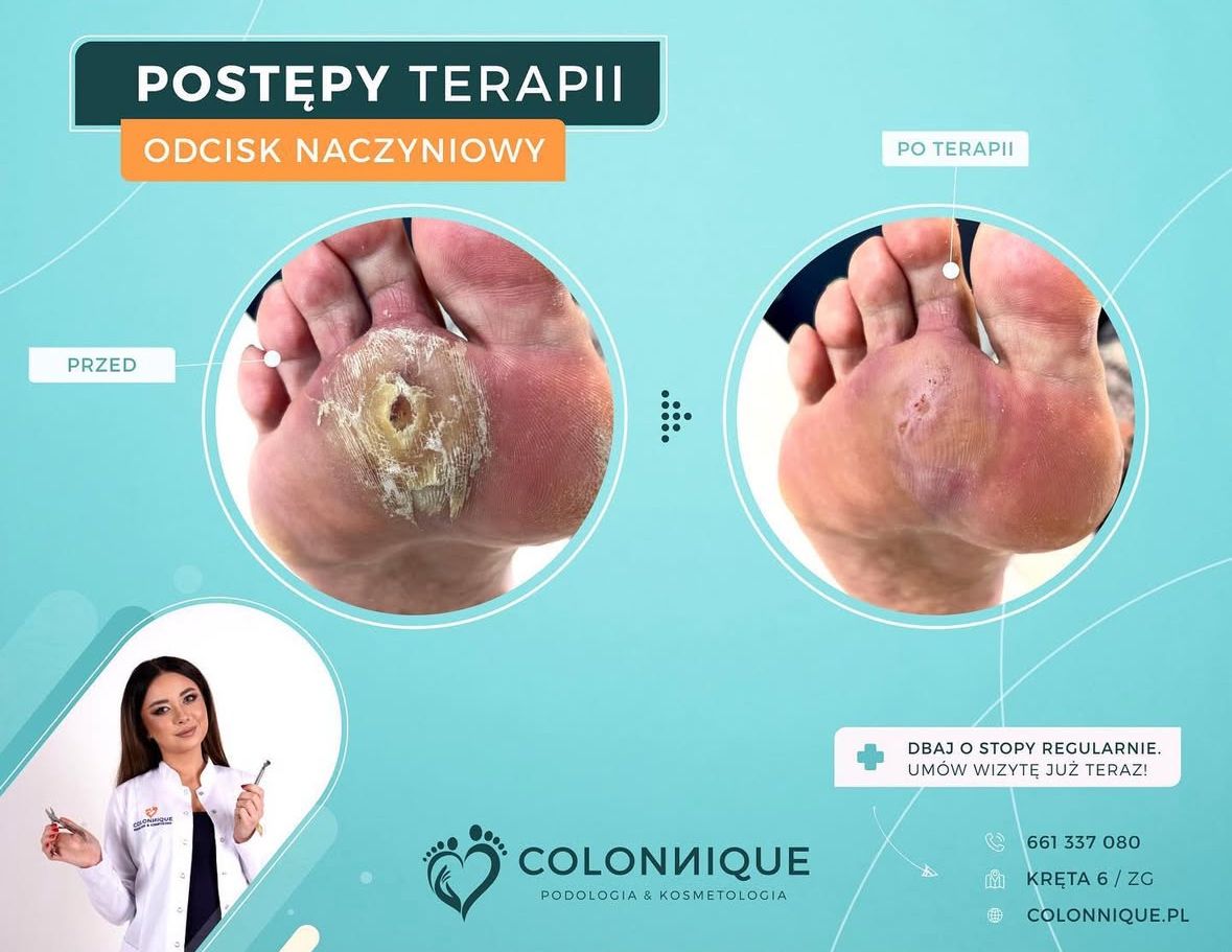 Karolina Colonna-Walewska-29