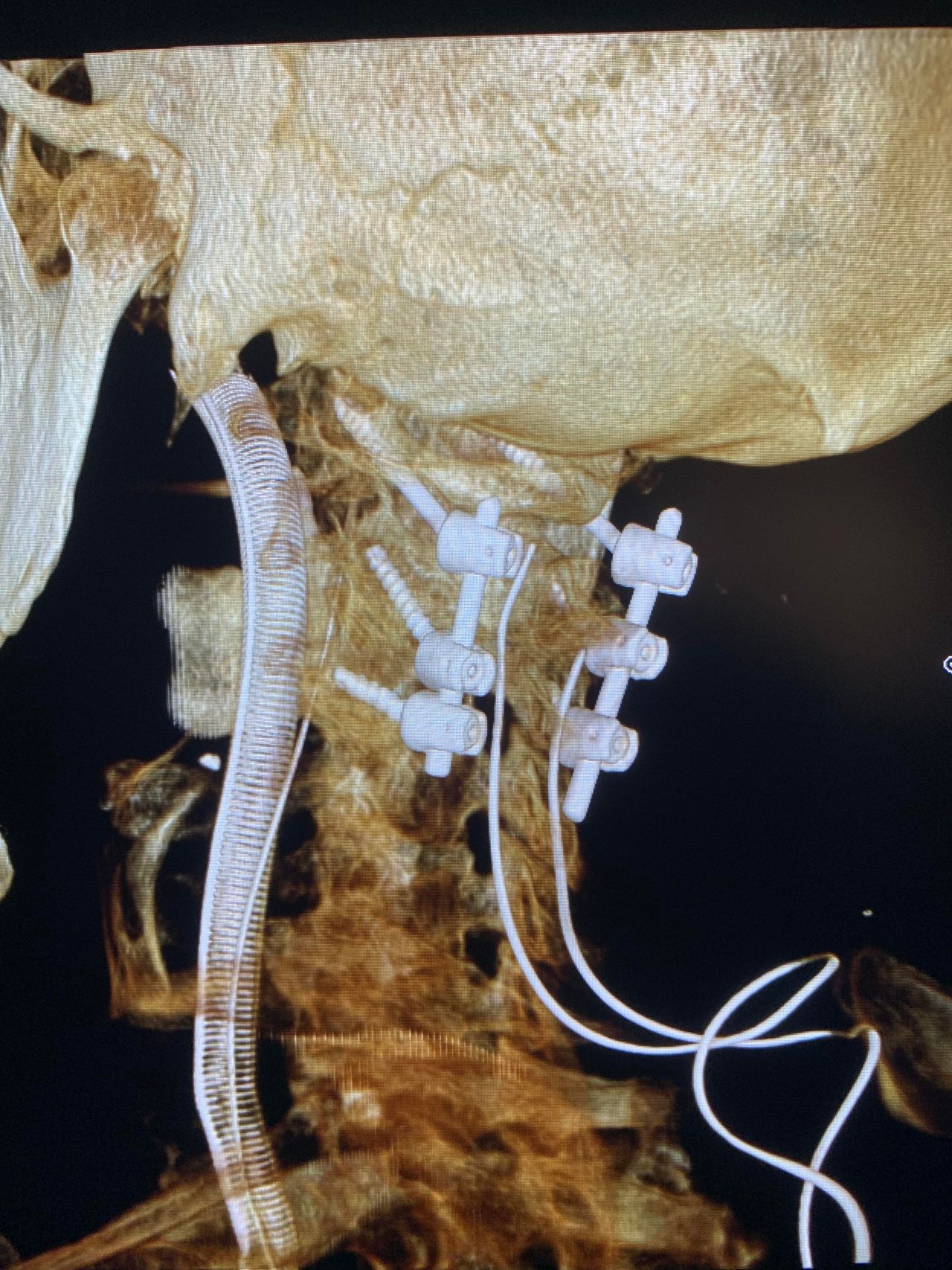 Daniele Millimaggi-13