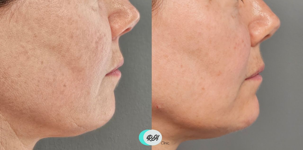 Rosalba Herrero Zerpa-612