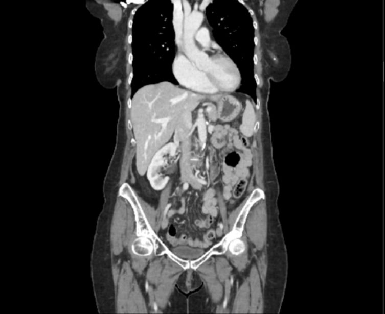 Tac Tomografia Computerizzata-1