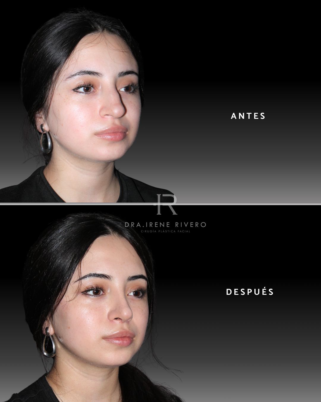 Irene Rivero-1