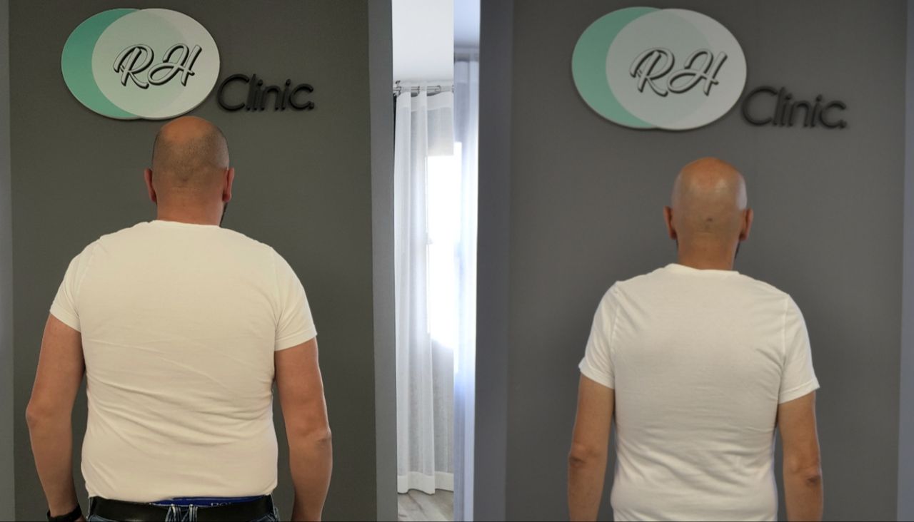 Rosalba Herrero Zerpa-173