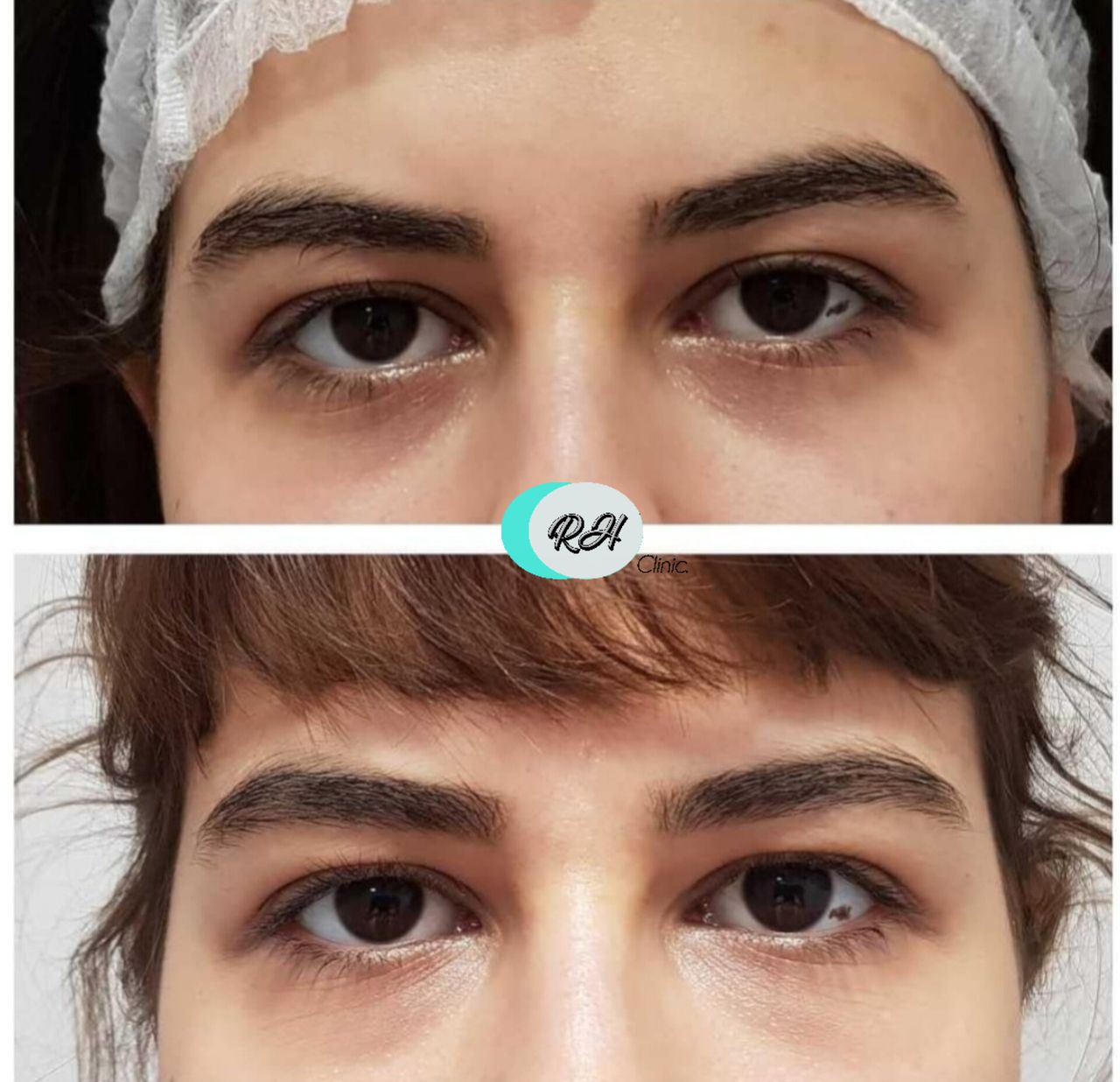 Rosalba Herrero Zerpa-608