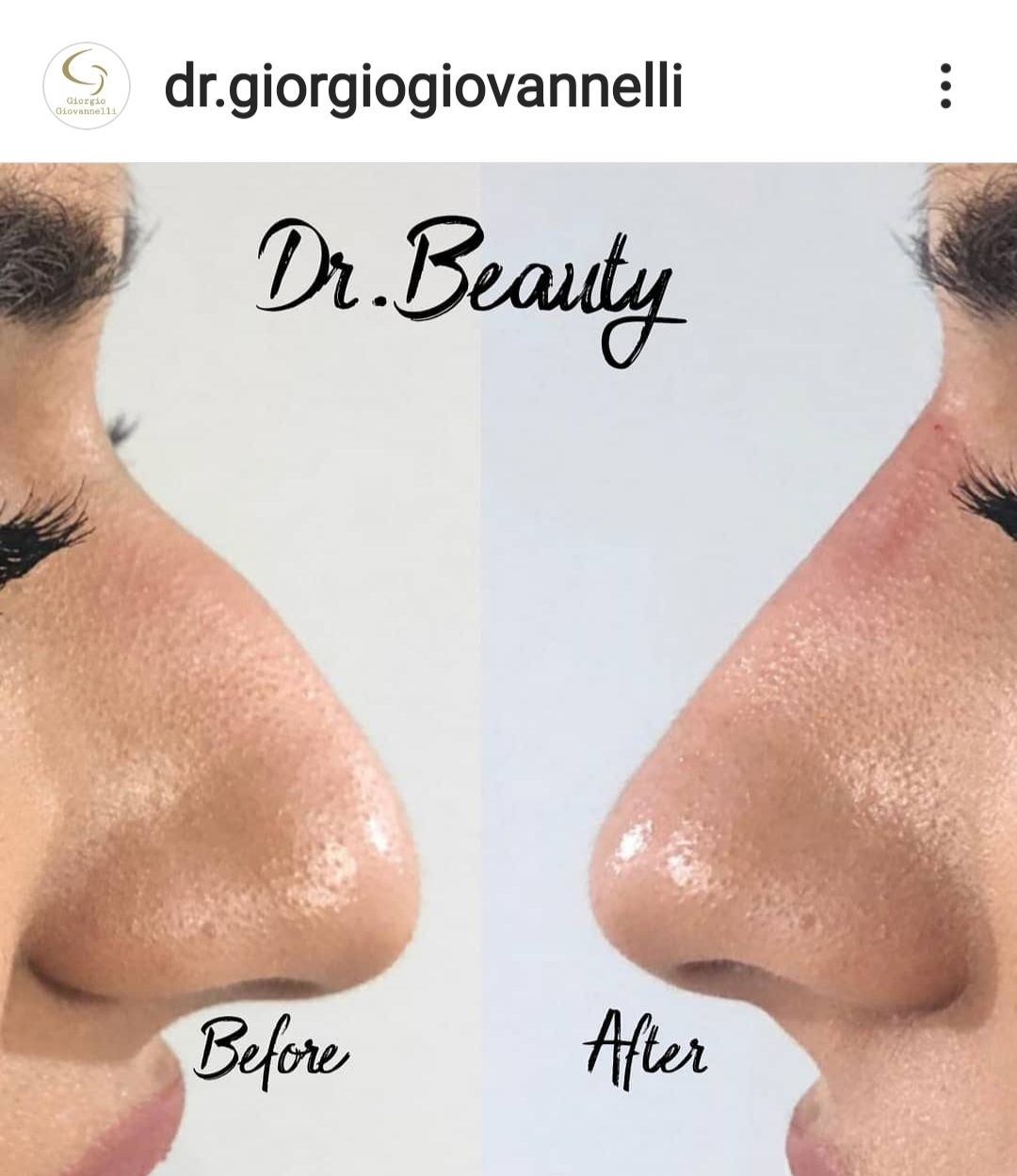 Giorgio Giovannelli-35