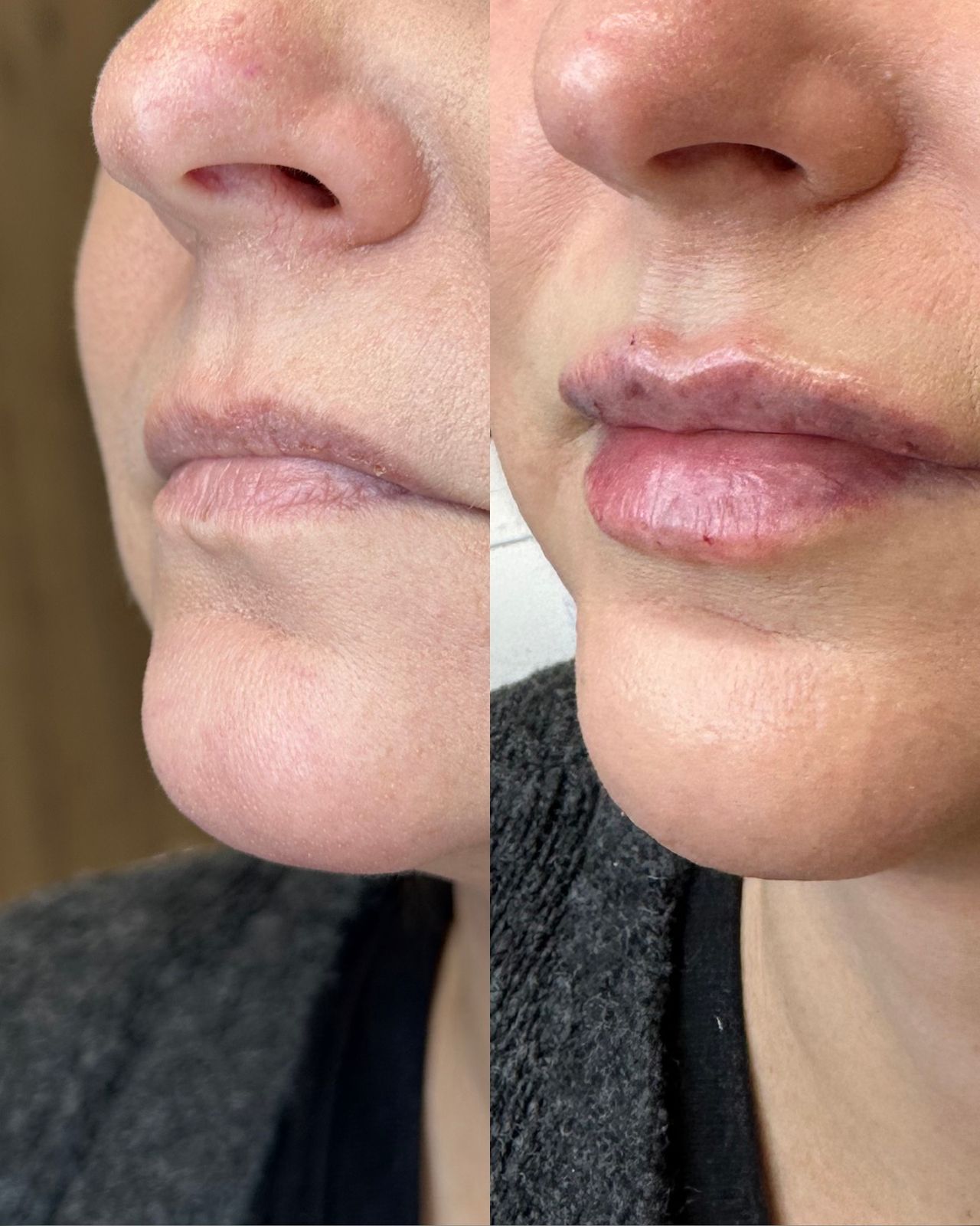 Michalina Zagańczyk-Bączek-43