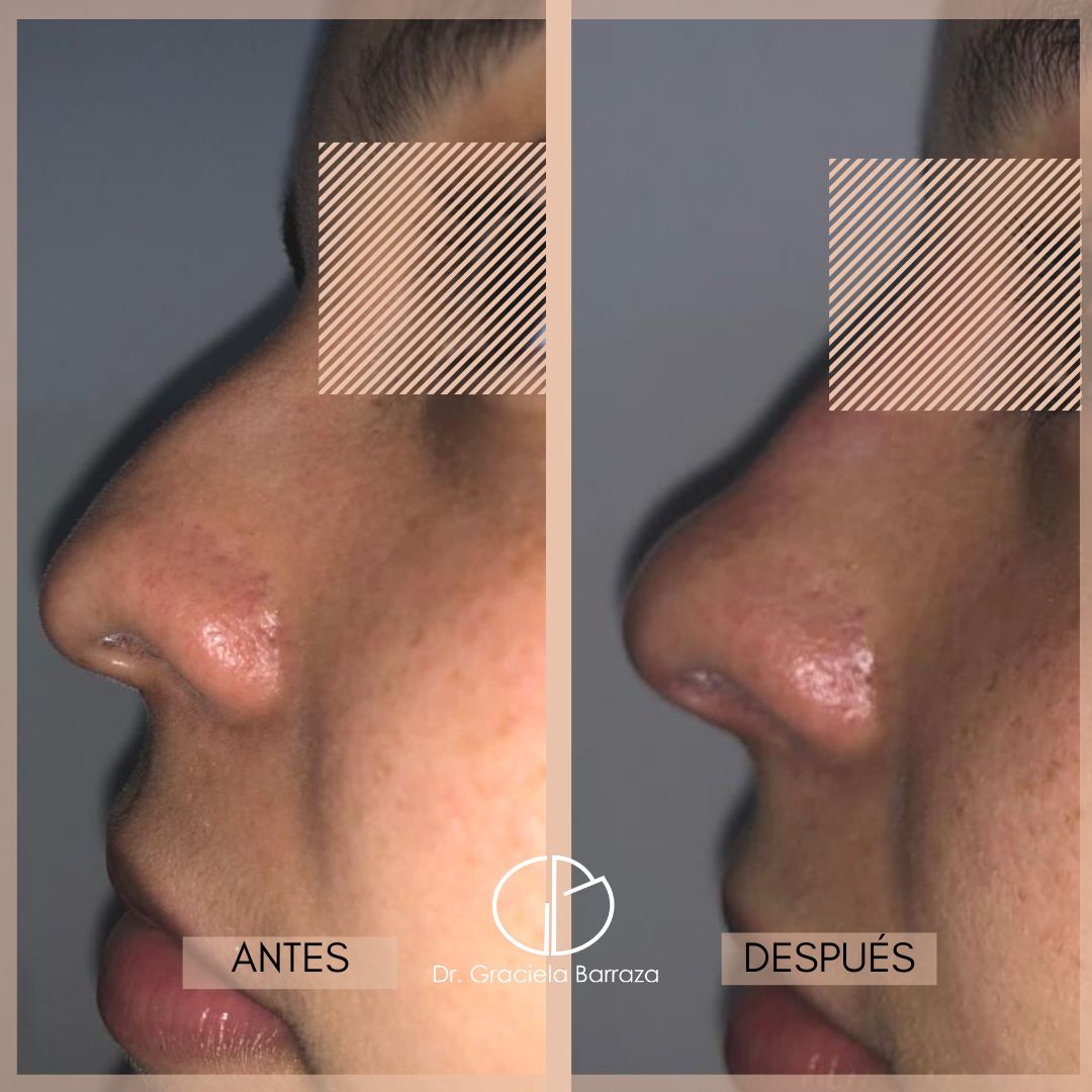 Graciela Barraza Jiménez-17