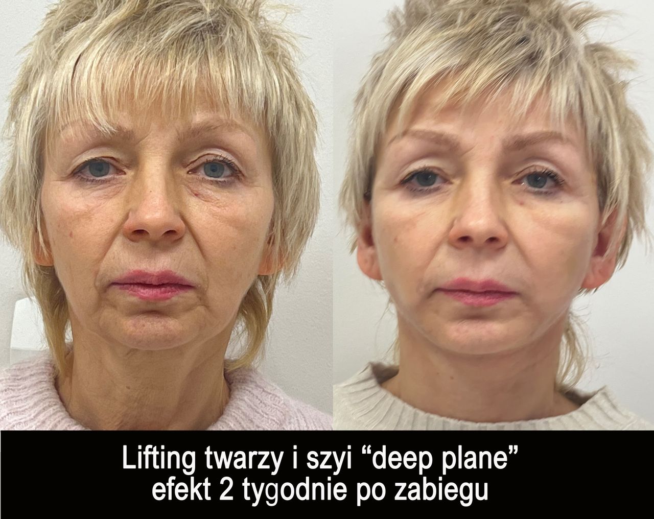 Mariusz Zagajewski-46