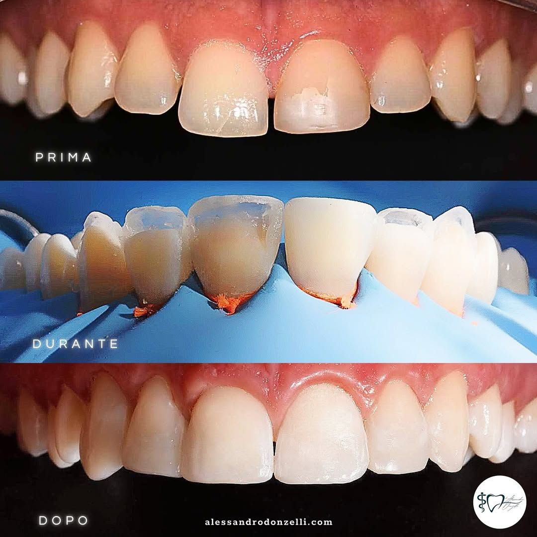 Alessandro Donzelli-9