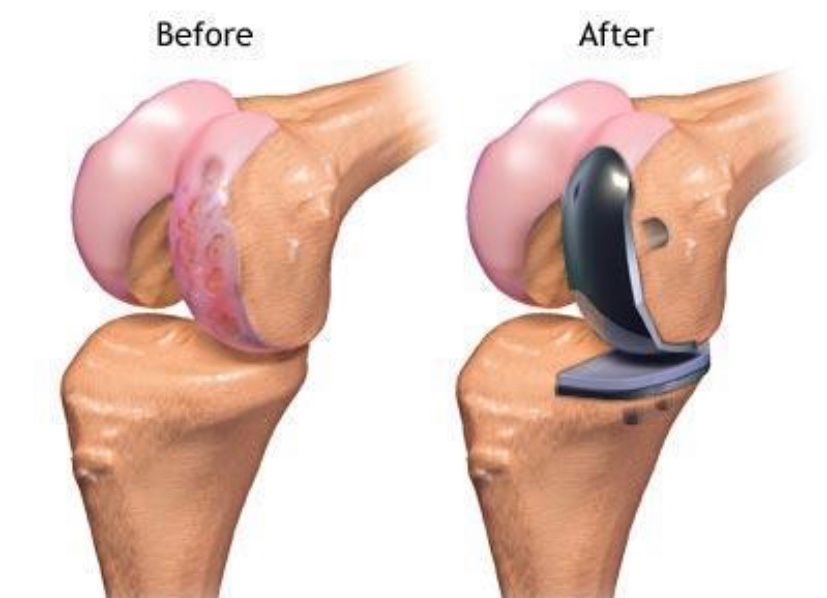 Pierpaolo Santoro-11