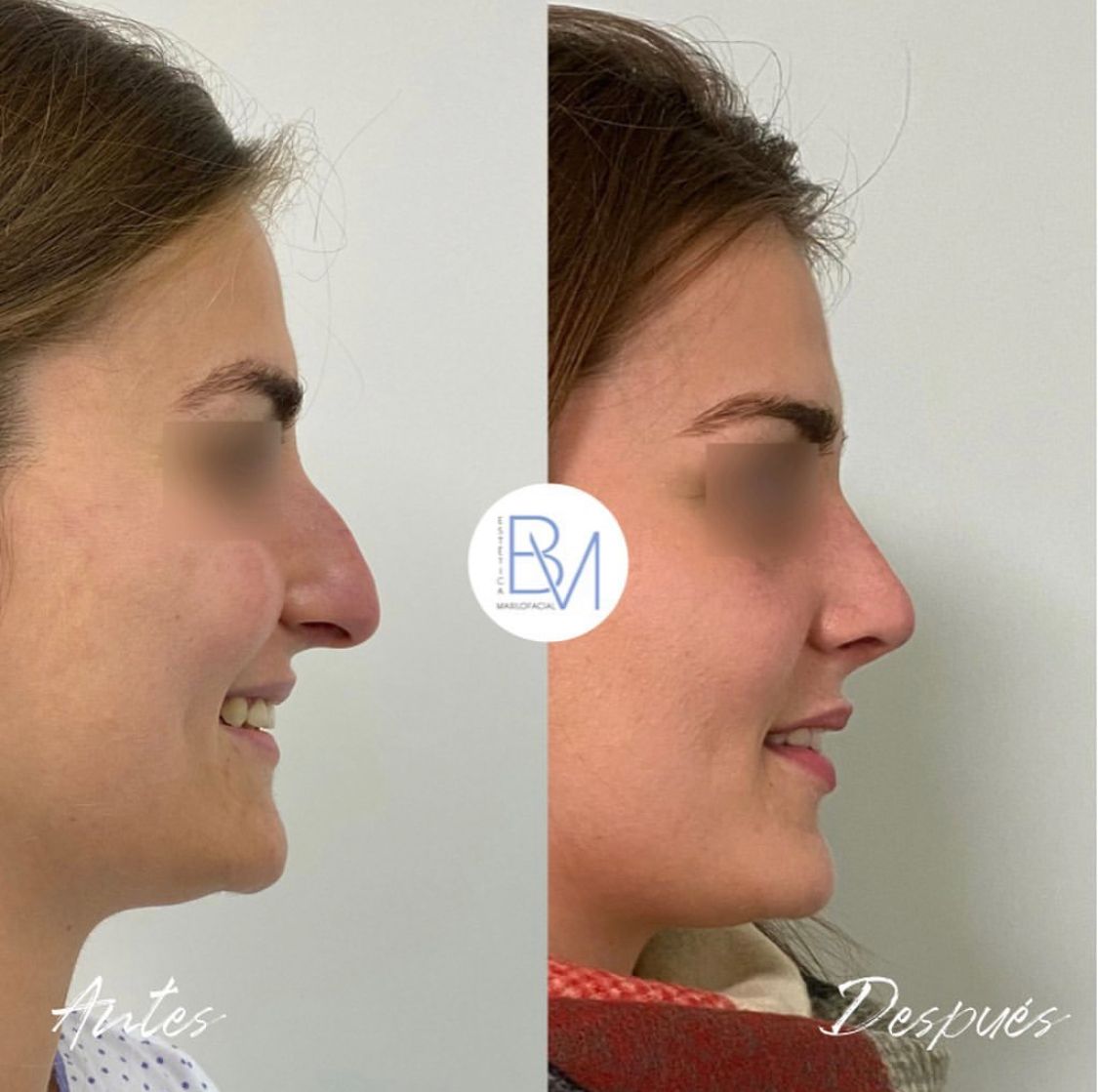 Beatriz Moralejo-115