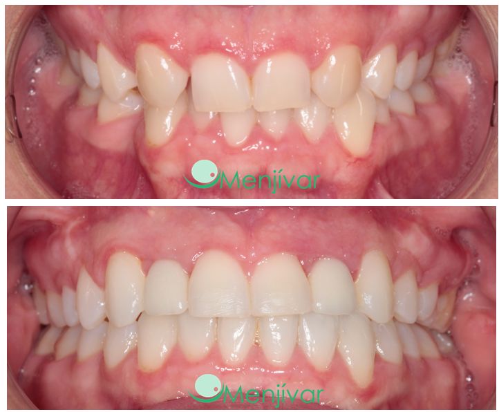 Ana Menjívar Galán-4