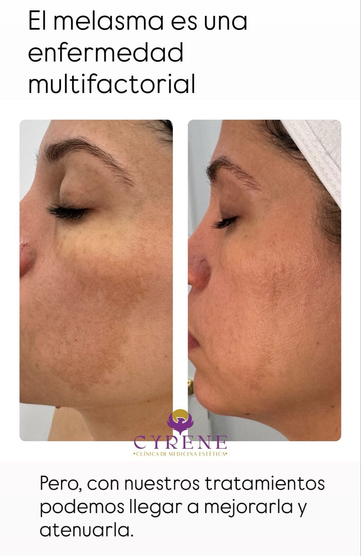 Yolimar Acevedo Raya-3