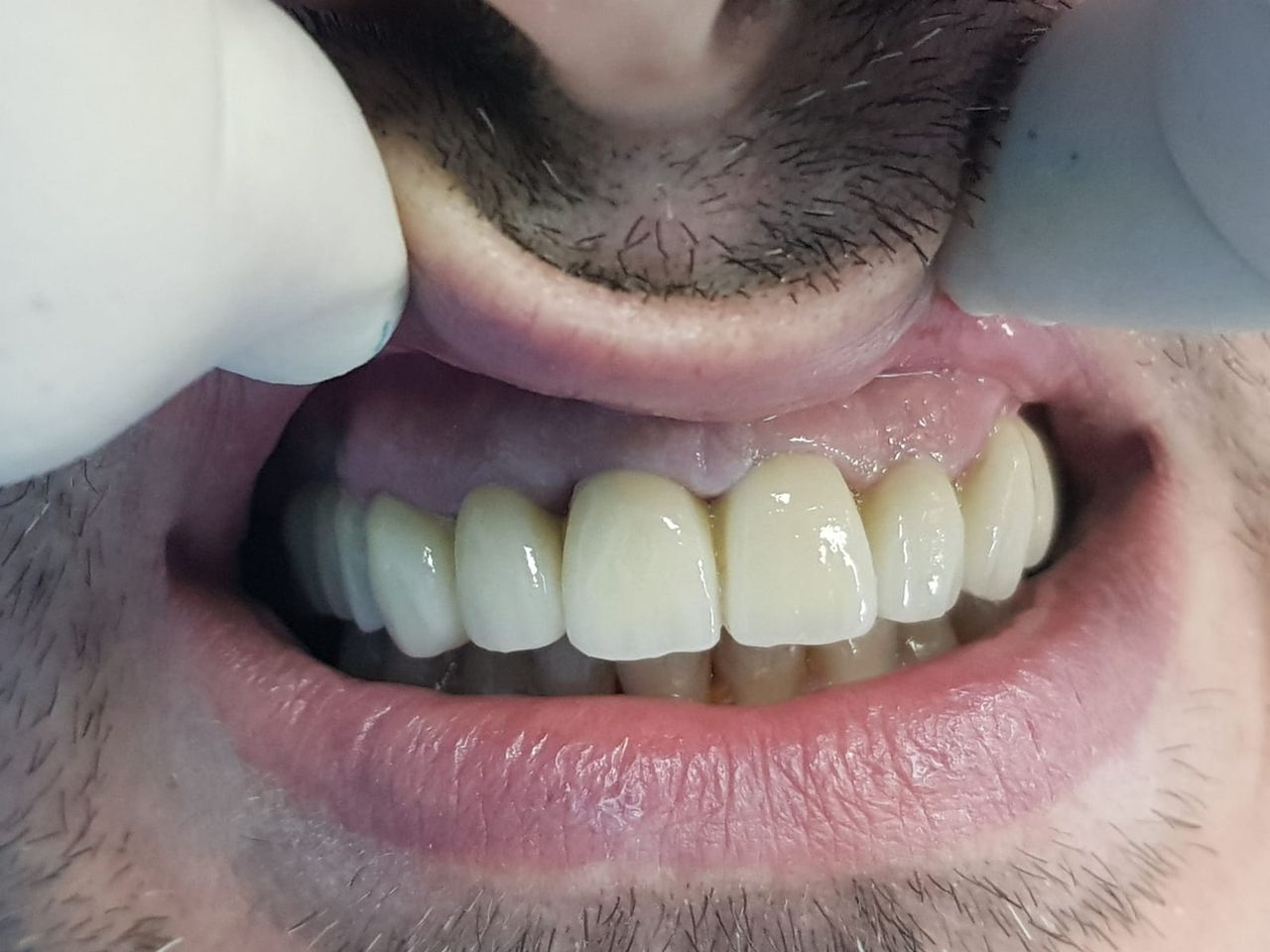 Stefano De Simone-107