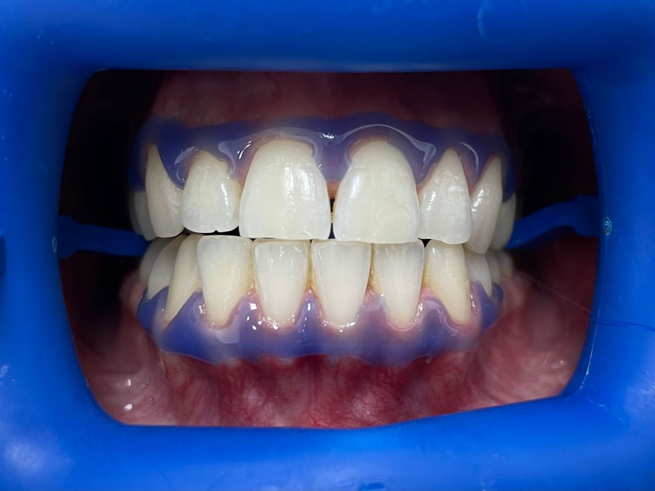 César Buján Riveiro-10