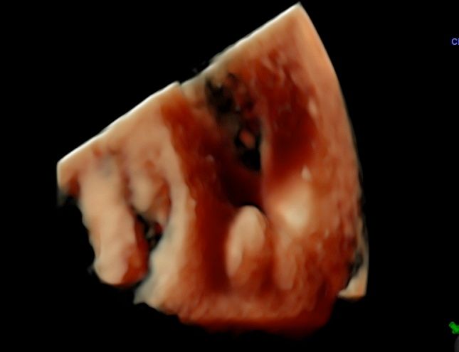 Tommaso Incandela-77