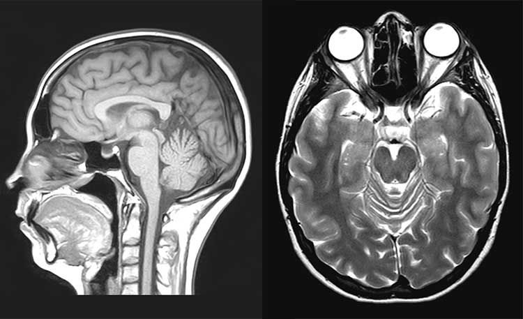 Risonanza Magnetica-0