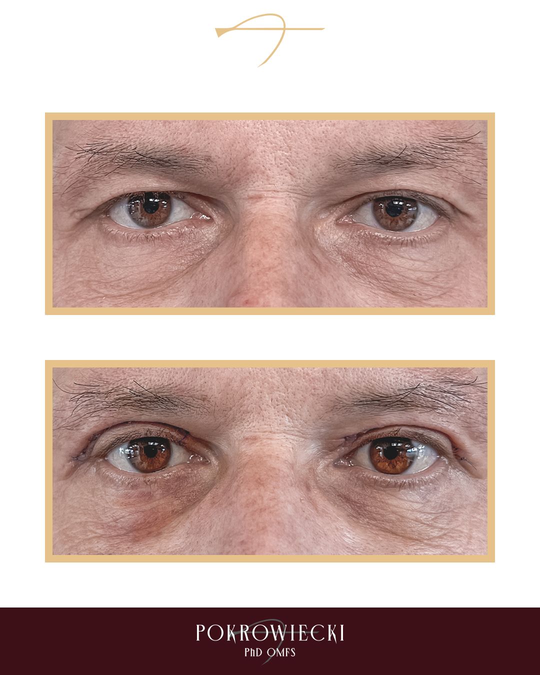 Rafał Pokrowiecki-12