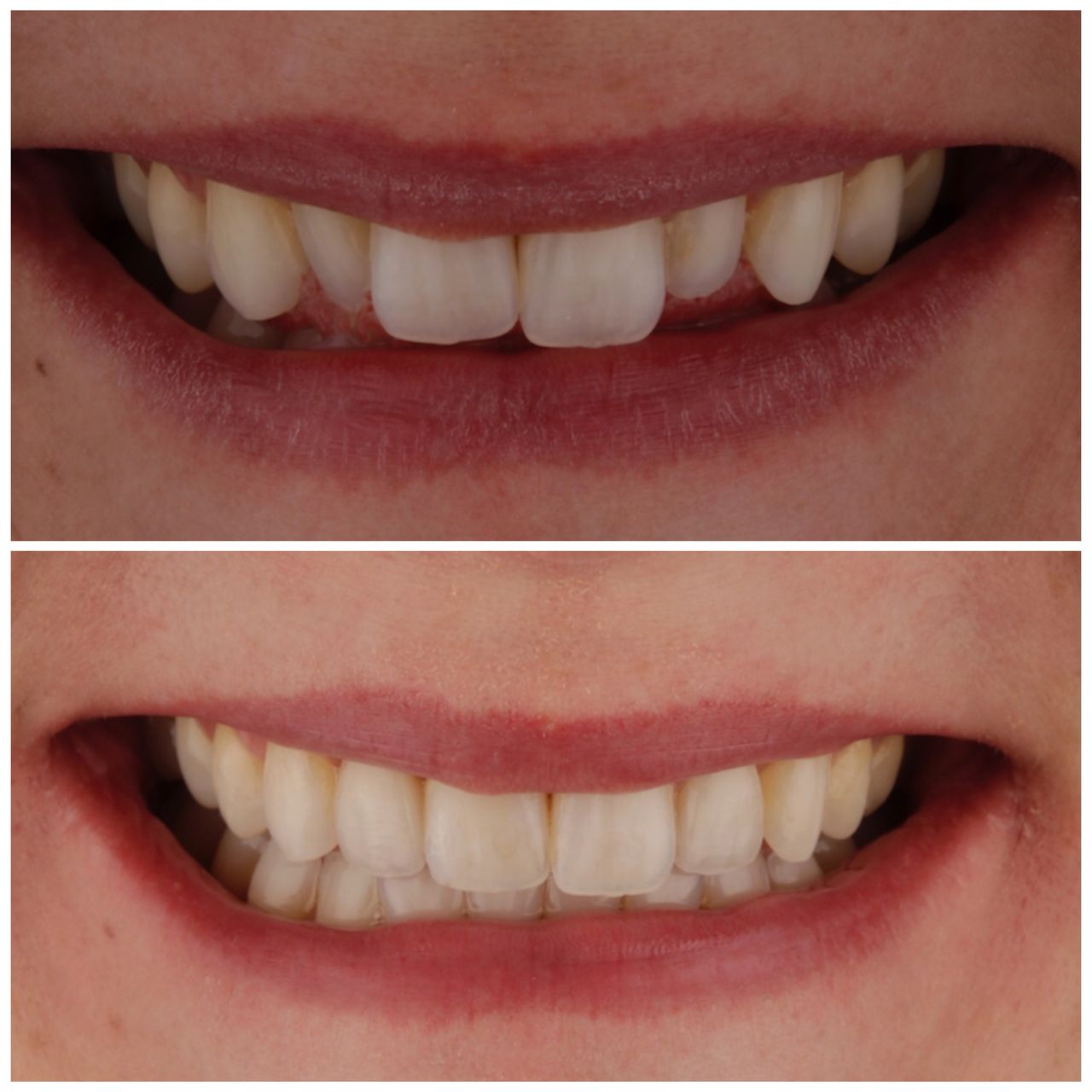 Gonzalo Navarro Boto-5