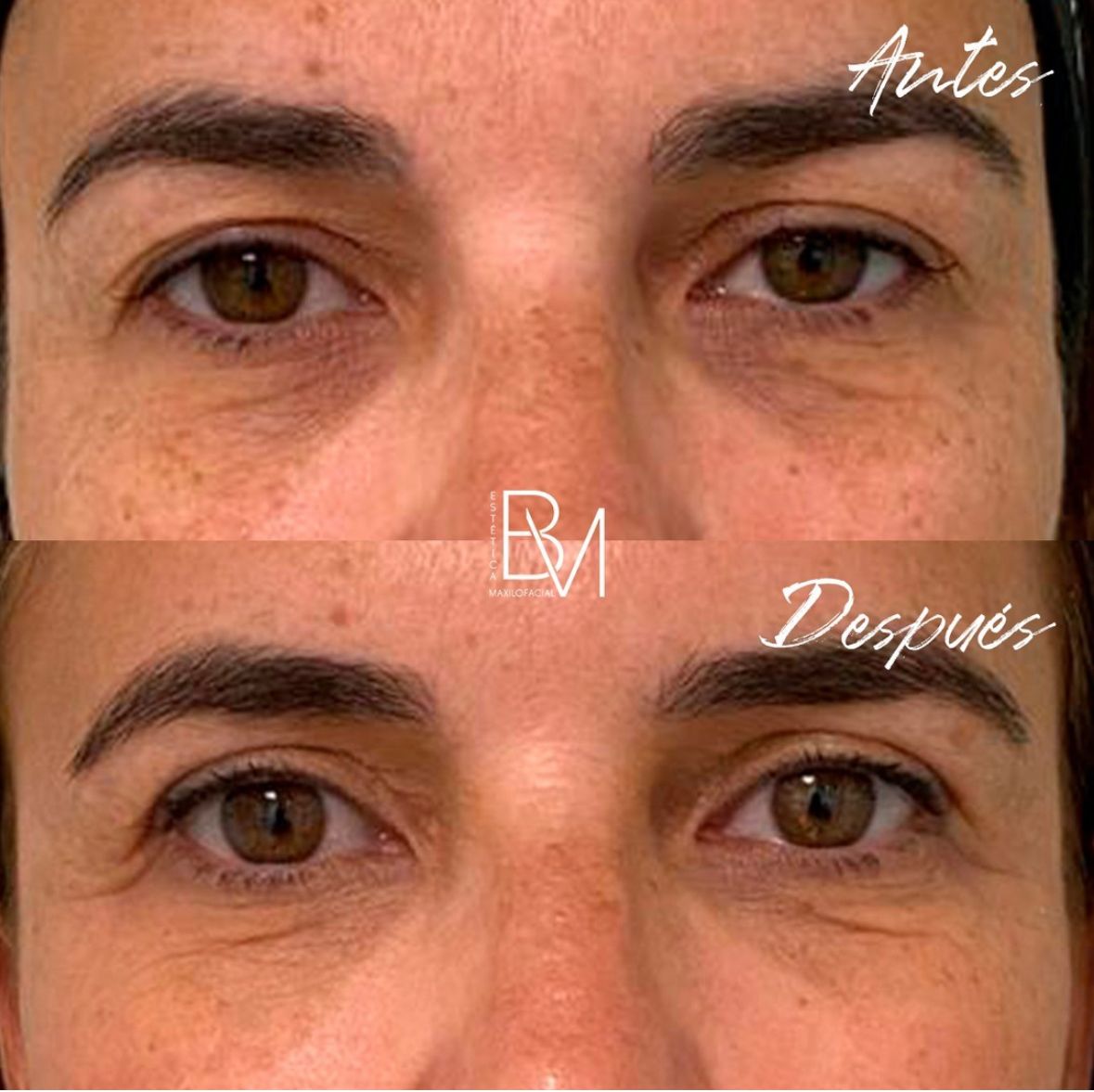 Beatriz Moralejo-81