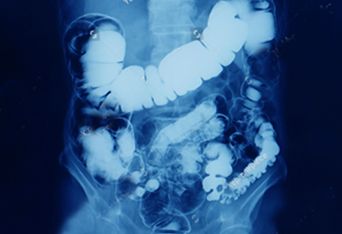 Antonio Gomez Ortega-6