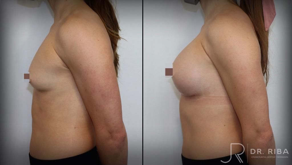 Jordi Riba Vilchez-34