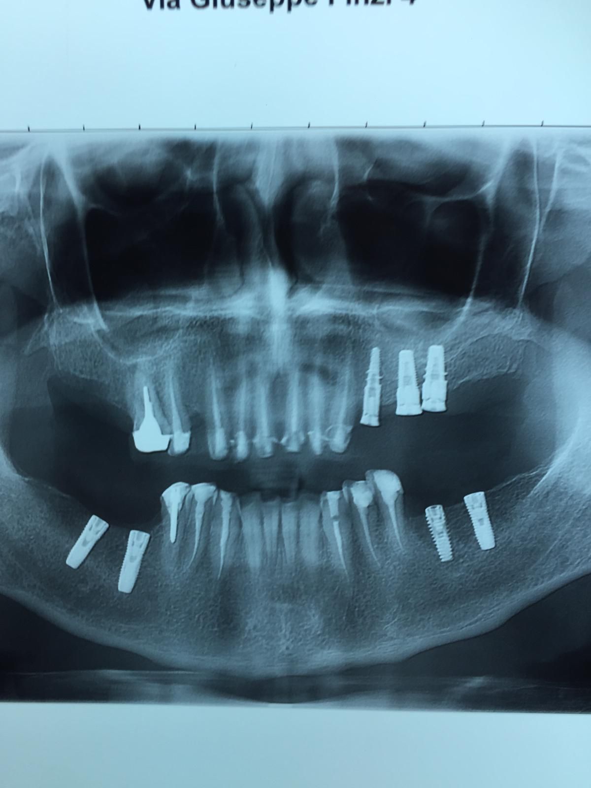 Alessandro Neglia-22