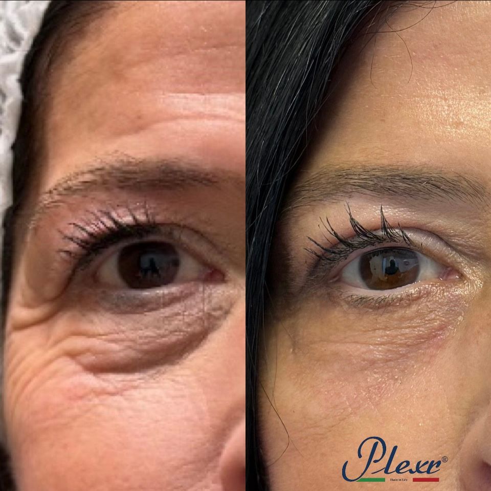 Raffaele Del Prete-14