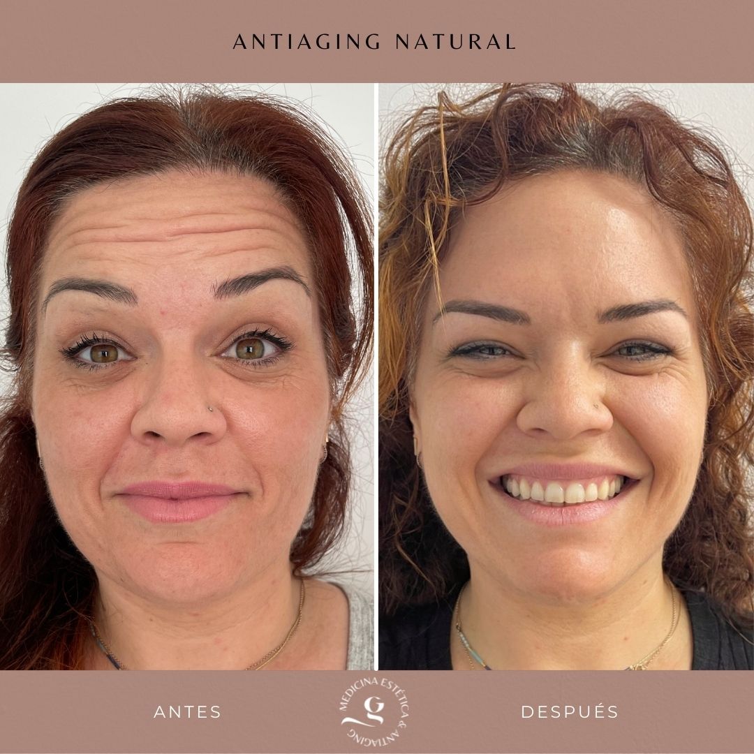 ​Giovanni Giorgianni-33