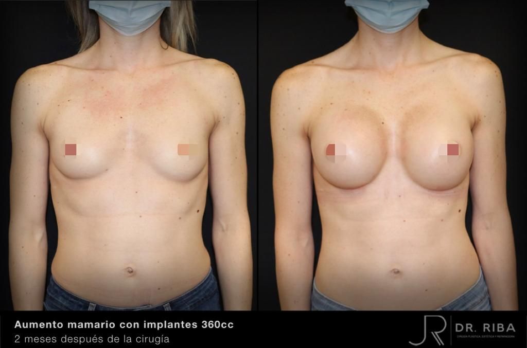 Jordi Riba Vilchez-16