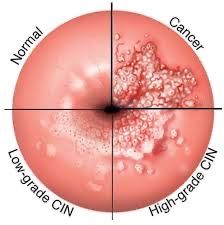 Vincenzo Massimo Prestia-46