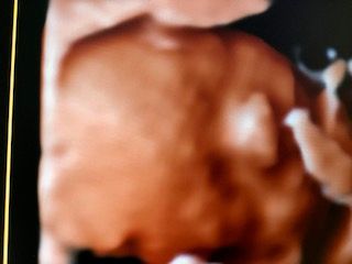 Domenico D'assisi-10