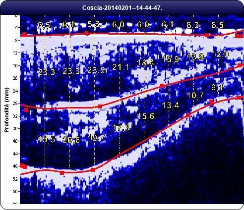 Antonella Vetrella-7