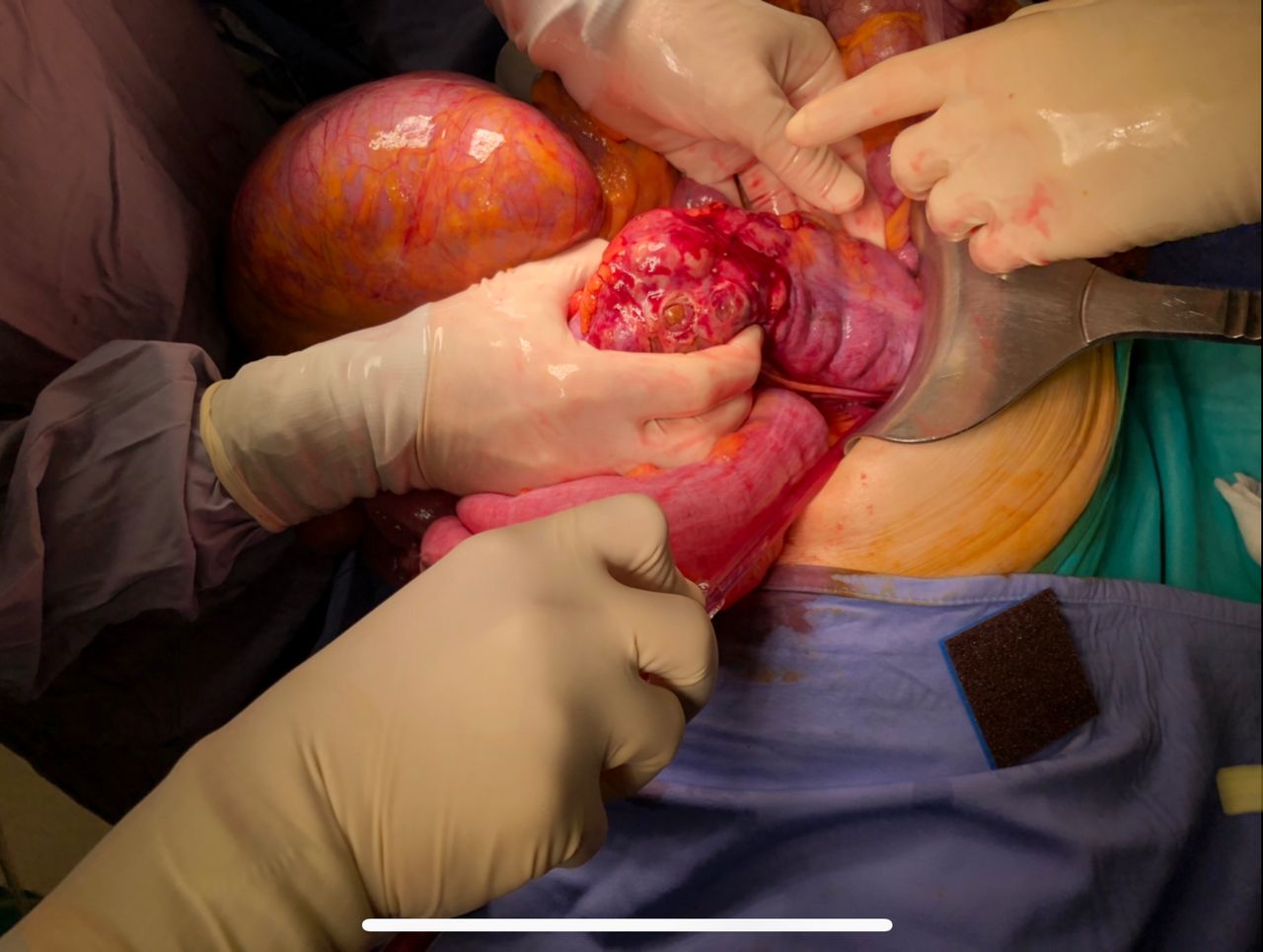 Antonio Ferronetti-3