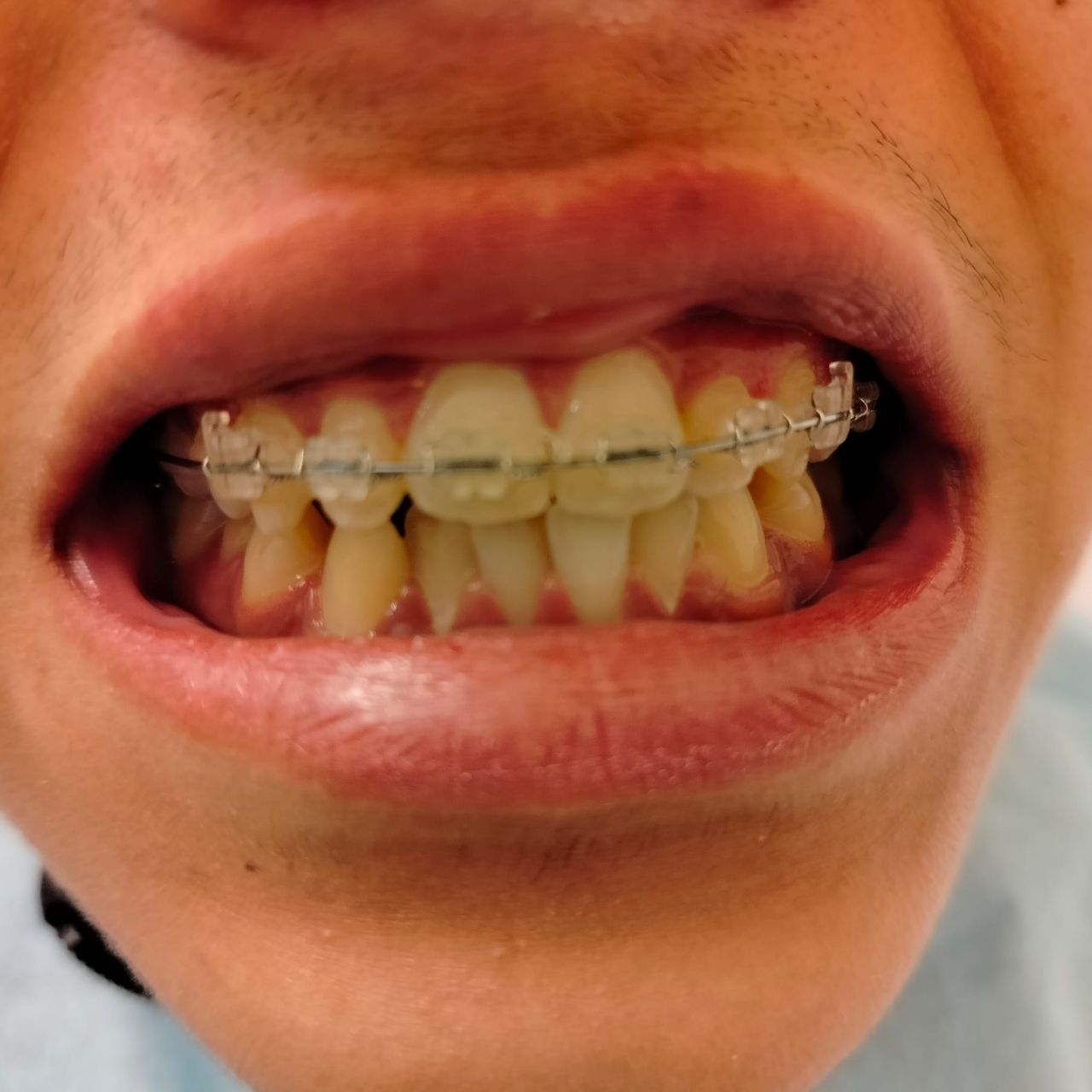 Marco Della Rovere-9