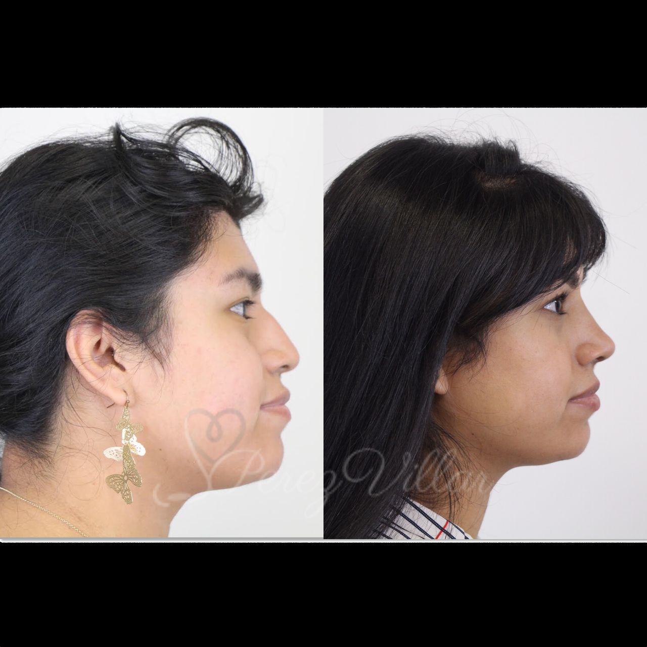 Alvaro Perez Villar-0