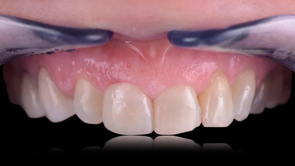 Riccardo Giardina-48