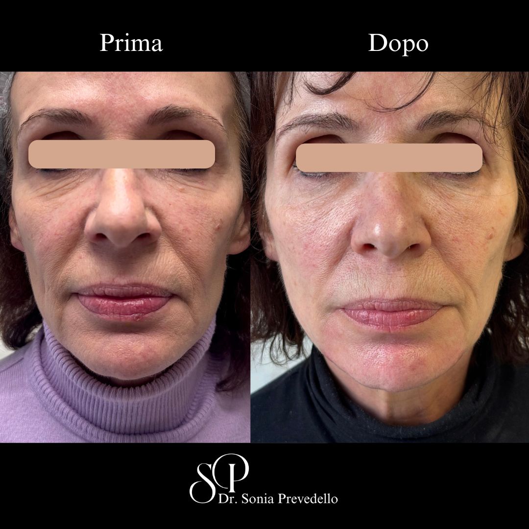 Sonia Prevedello-26