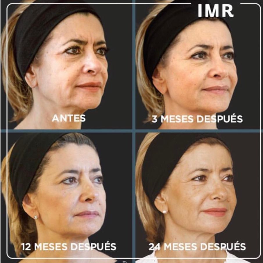 Cristina Corredera Carrión-2