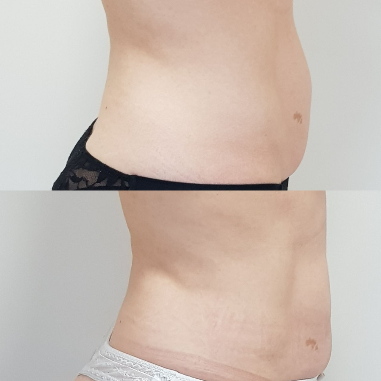 Rosalba Herrero Zerpa-293