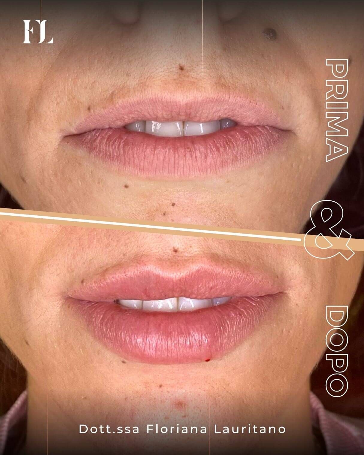 Floriana Lauritano-11