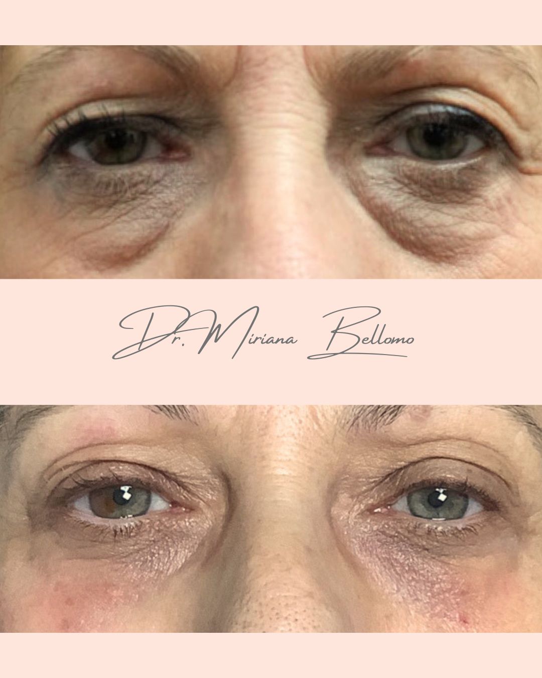 Miriana Bellomo-17