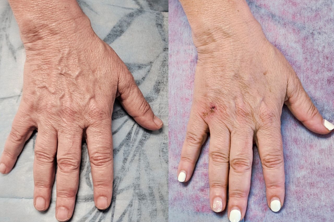 Rosalba Herrero Zerpa-616