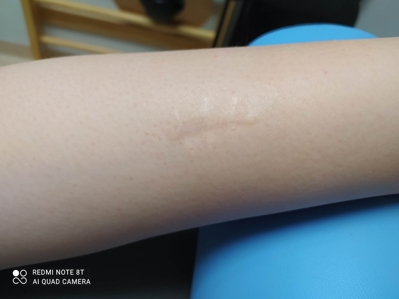 Aneta Kołodziejczyk-4