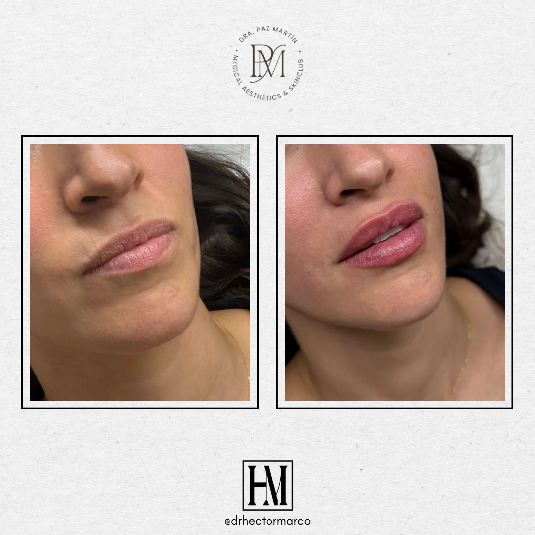 Héctor Marco Ruiz-16