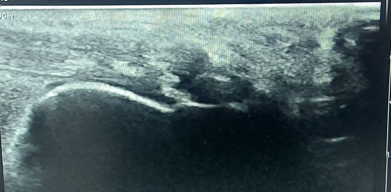 Álvaro Cerezuela Sánchez-13