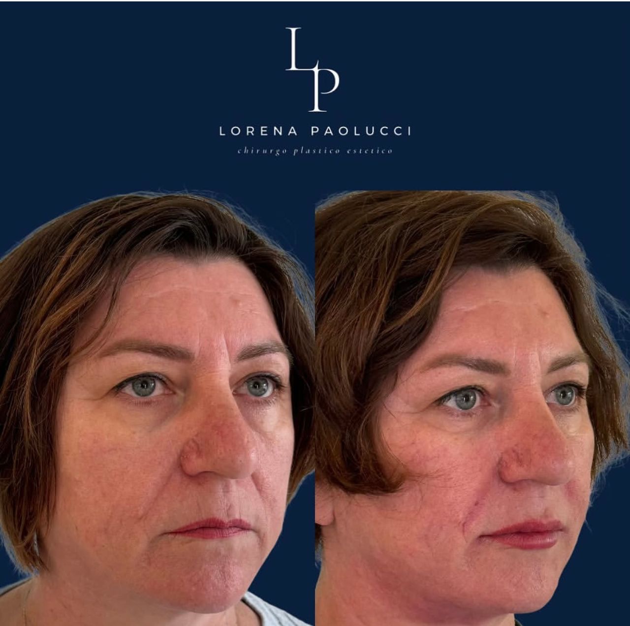 Lorena Paolucci-46