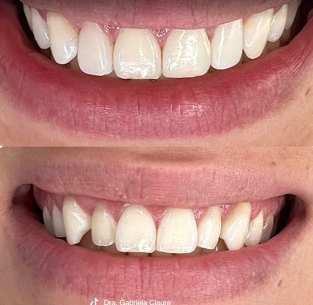 Alcira Gabriela Claure-8