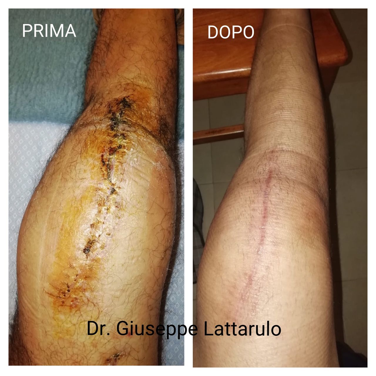 Giuseppe Lattarulo-4