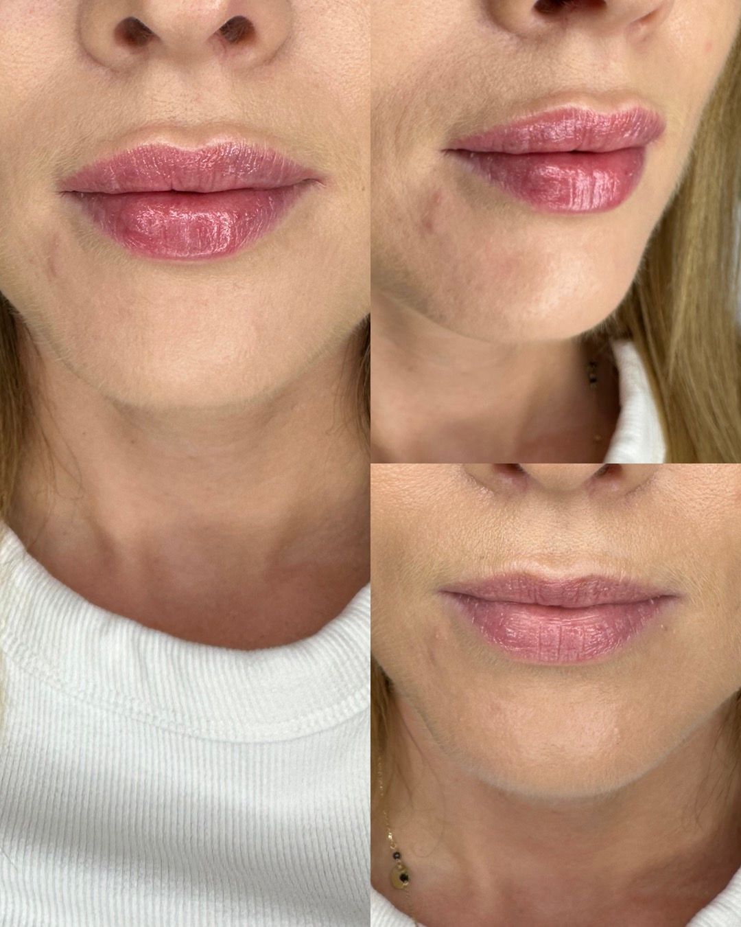 Michalina Zagańczyk-Bączek-23