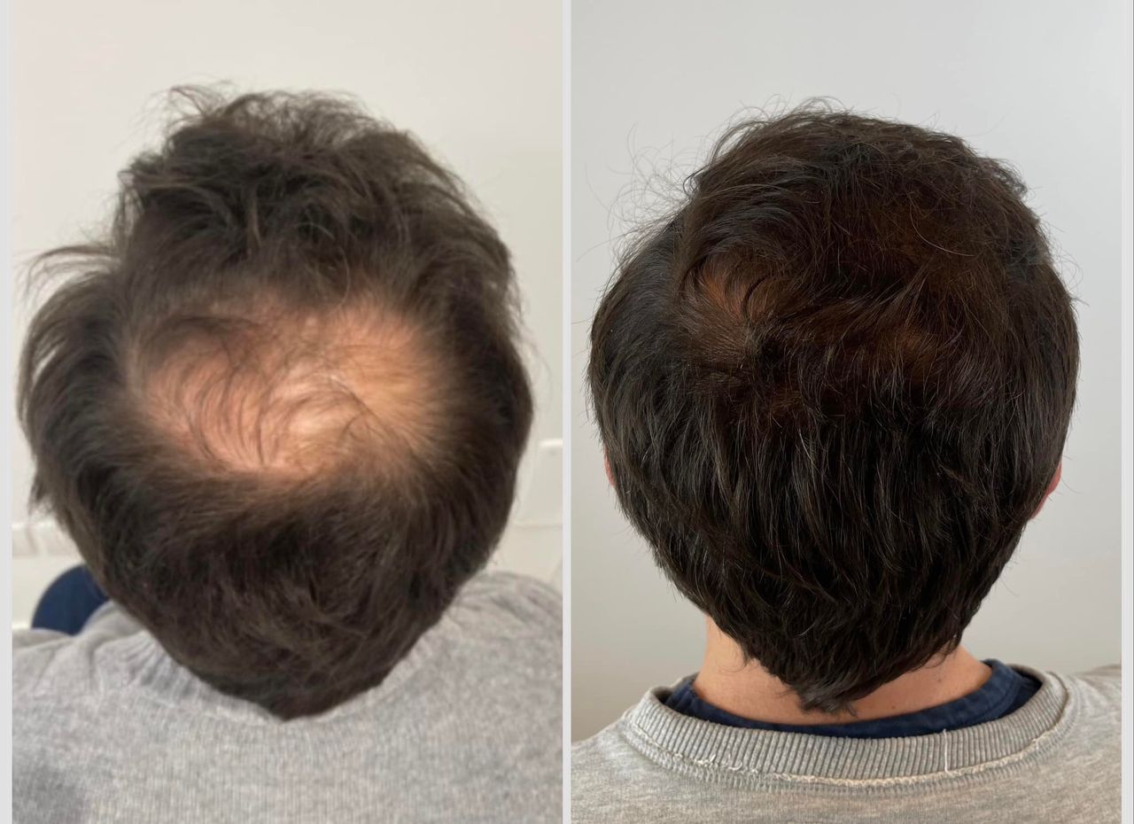 Fabrizio Barattolo-18